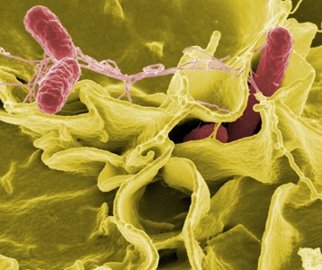 1000minds used to prioritize drug-resistant bacterial infections to guide R&D into new antibiotics